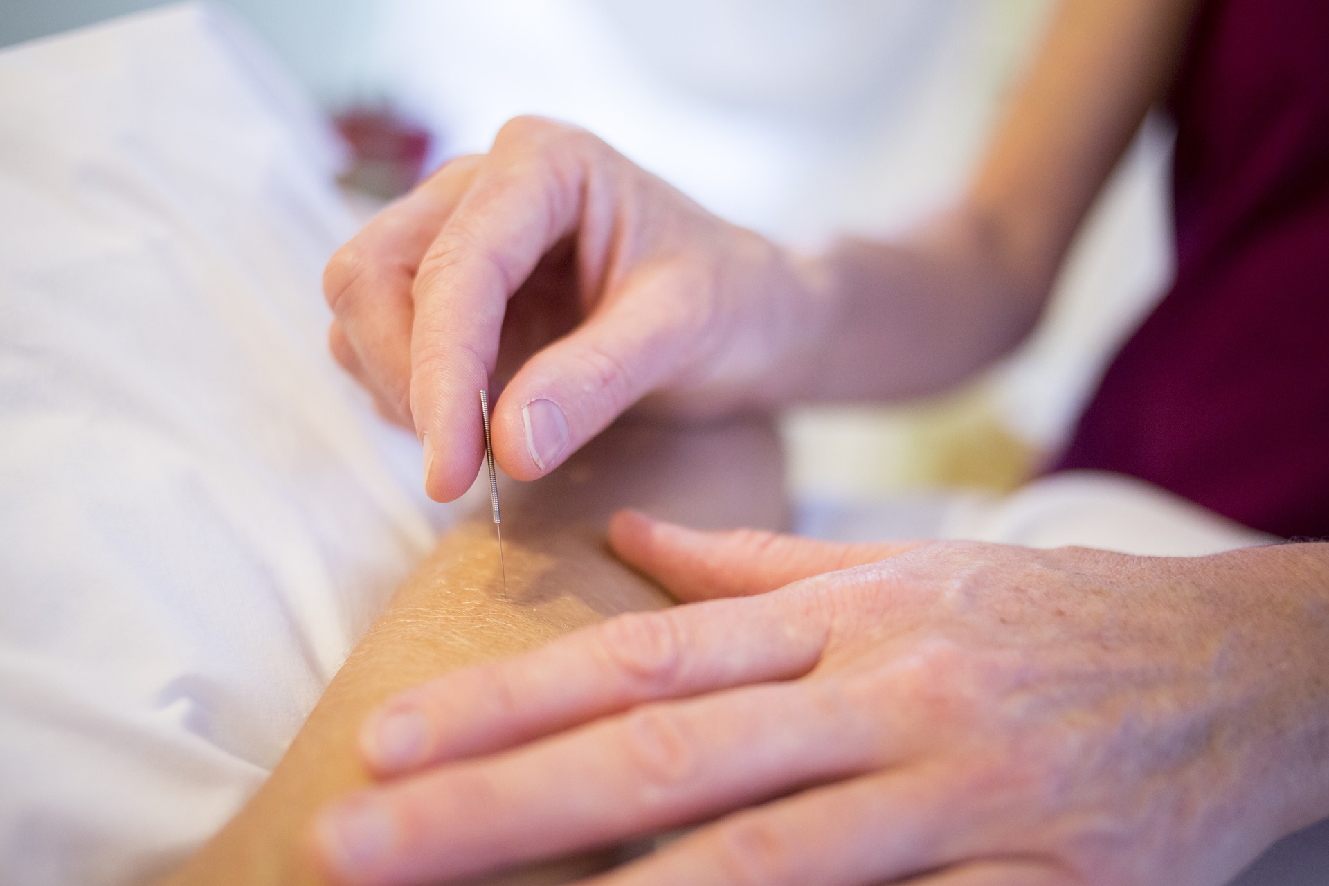 17i Best Acupuncture in Frisco
